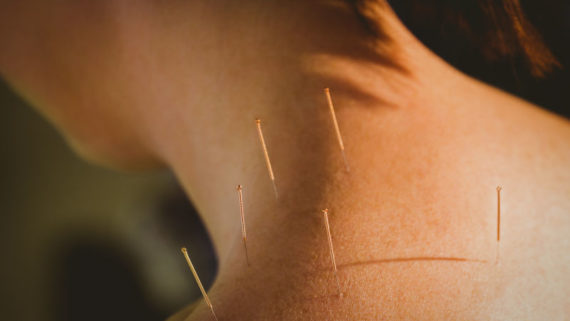 acupuncture for prenatal and postpartum
