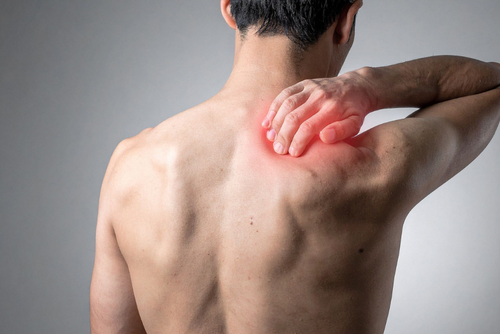 Frozen Shoulder
